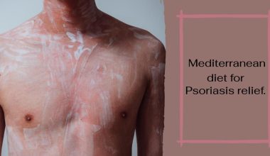 Mediterranean Diet for Psoriasis Relief