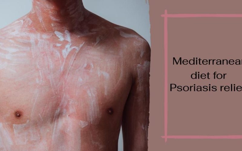 Mediterranean Diet for Psoriasis Relief